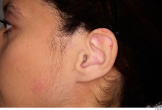 Jimena ear 0001.jpg